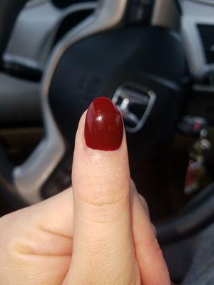 Right thumb is crooked going towards the left