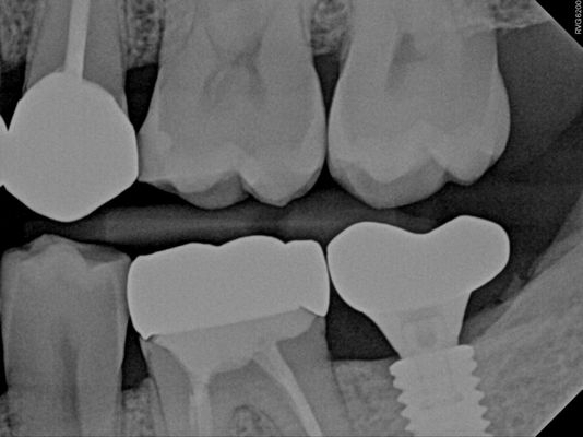 Endodontic Excellence