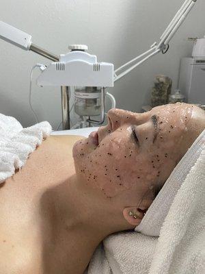 Teen/young adult acne facials