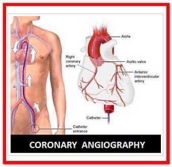 Coronary Angiography