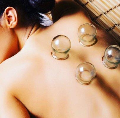 Cupping treatment