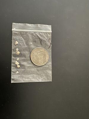 All of the fillings that weren't swallowed or lost, and able to be saved. a quarter next to them for reference.