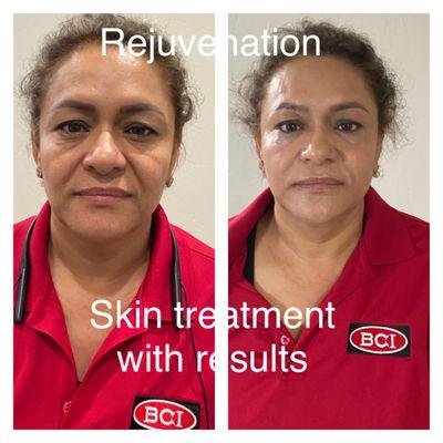 Customized skin treatment with results.