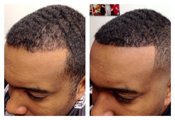 Edge up enhancement