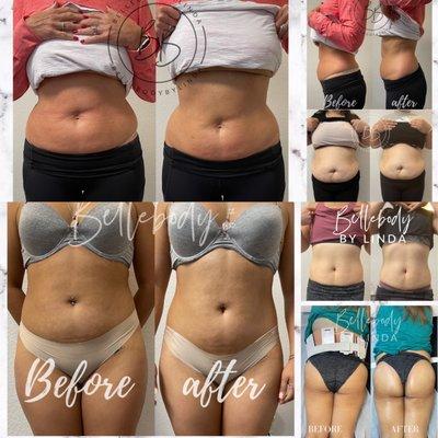 Clients results, more results on IG @bellebodybylinda