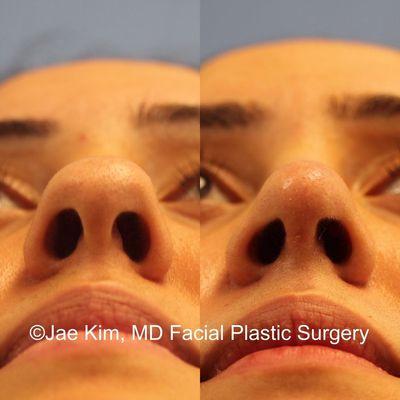 Jae Kim, MD Facial Plastic Surgery