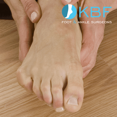 Hammertoe treatment