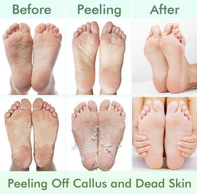 Exfoliaciones para pies             Exfoliating Foot mask