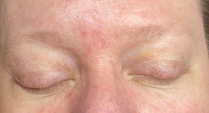 brow before-no make up so she can see true skin tone