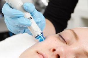 HydraFacial treats acne, fine lines/wrinkles, uneven tone/texture, sun damage, hyper pigmentation, dehydrated skin as well as sensitive skin