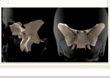 The Sphenoid