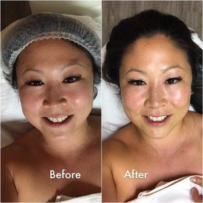 Before/After anti-aging facial w/Jessica. I get mistaken for someone in their 20's but I'll be turning 40 yrs old next month!