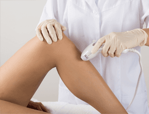 Offering laser hair removal