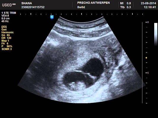 Newnan Ultrasound Services