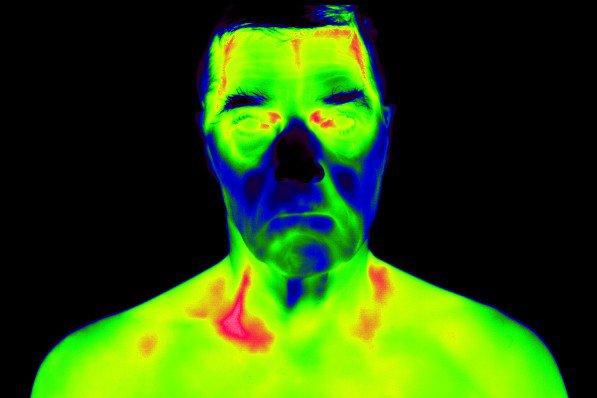 Cranial Thermography