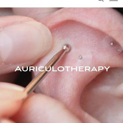 Auriculotherapy- Ear Reflexology www.SarangHealing.com