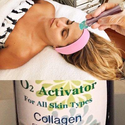 *Treatment with Hydrodermabrasion & Oxigen Therapy* $80