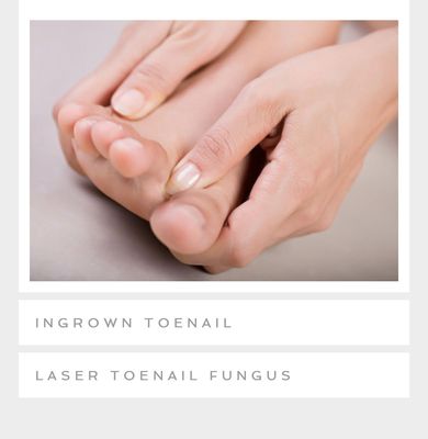 Permanent Solution for Ingrown Toenail.