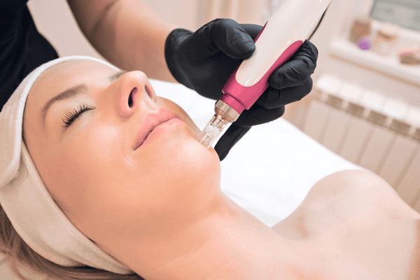 Microneedling