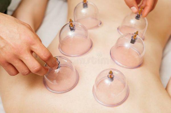 Vacuum Cupping