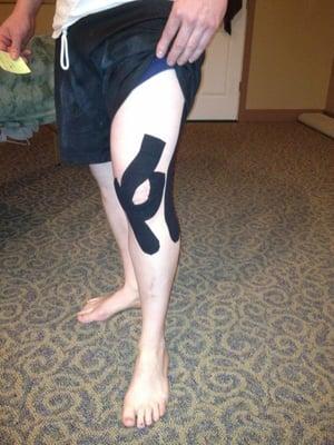 Kinesio tape for runners knee