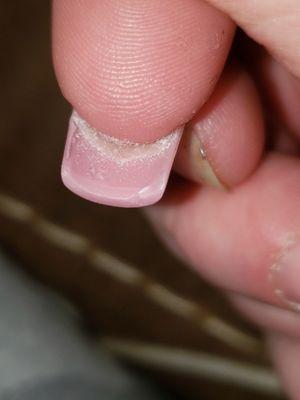 One of many chipped/jagged nails either crap left underneath.