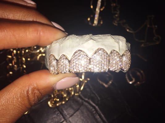 Custom 14k and Diamond Grill