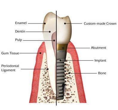 Invisalign Dentist