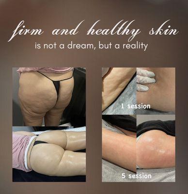 firm and healthy skin is not a dream, book your appointment, call us 646-453-9492